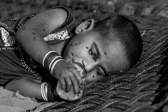 Flies on the Baby Face Flies on the Baby Face